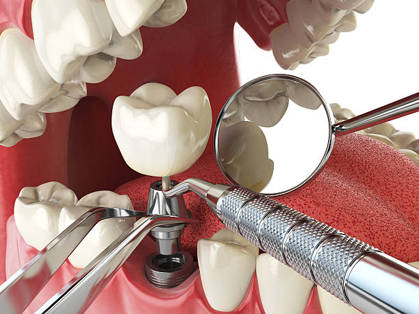 Best Mobile Emergency Dentist in Osage City, KS